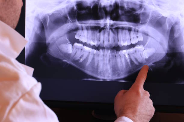 Best Emergency Dental Care for Sports Injuries in Stansbury Park, UT